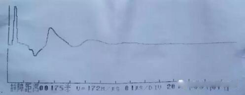 �}�_���yԇ��|ȫ�L����